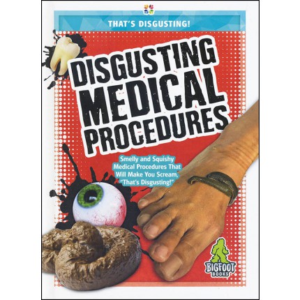 That's Disgusting - Disgusting Medical Procedures